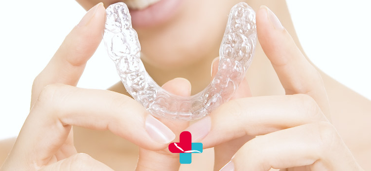 Invisalign: una soluzione per tanti problemi